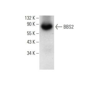 BBS2 Antibody (A-12): sc-365355
