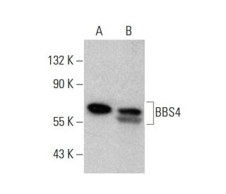 BBS4 Antibody (1292CT845.130.218) - Western Blotting - Image 376894