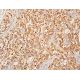 BBS5 Antibody (B-11) - Immunohistochemistry - Image 411706 
