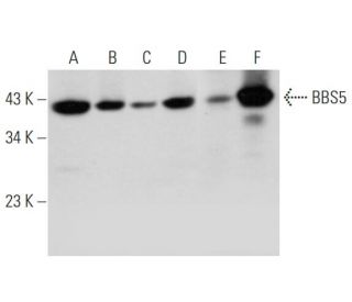 BBS5 Antibody (B-11) - Western Blotting - Image 345924 