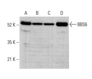 BBS6 Antibody (F-8) - Western Blotting - Image 375541 