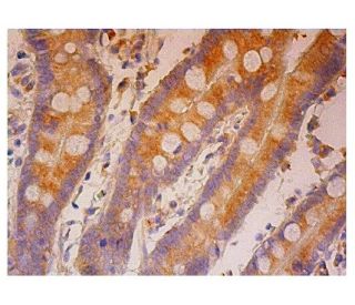 BCDIN3D Antibody (F-5) - Immunohistochemistry - Image 301867 