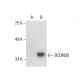 BCDIN3D Antibody (F-5) - Western Blotting - Image 287818