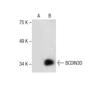 BCDIN3D Antibody (F-5) - Western Blotting - Image 287820Each CRISPR/Cas9 Knockout (KO) Plasmid product consists of a pool of 3 plasmids designed to ensure identification and cleavage of a specific gene for maximum knockout efficiency. Each plasmid encodes a unique 20 nt sequence derived from the GeCKO (v2) library.