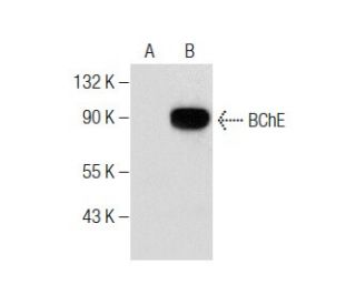 BChE Antibody (D-5) - Western Blotting - Image 284397SAM Transcription Activation: SAM system utilizing dCas9-VP64, MS2-P65-HSF1, and sgRNA for precise gene transcription activation. 