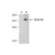BCKDHB Antibody (H-6) - Western Blotting - Image 314509 