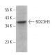 BCKDHB Antibody (H-6) - Western Blotting - Image 370094