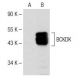 BCKDK Antibody (E-12) - Western Blotting - Image 150596