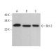 Bcl-2 Antibody (12) - Western Blotting - Image 379628 