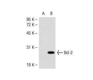 Bcl-2 Antibody (YTH10C4) - Western Blotting - Image 51270 