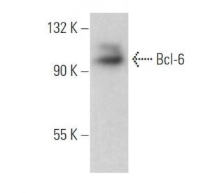 Bcl-6 Antibody (7D1) | SCBT - Santa Cruz Biotechnology
