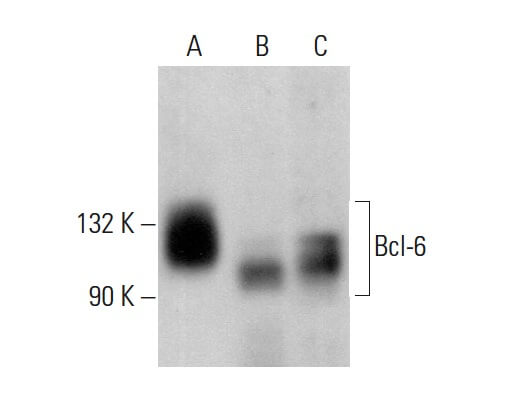 Bcl-6 Antibody (7D1) | SCBT - Santa Cruz Biotechnology