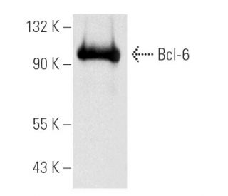 Bcl-6 Antibody (D-8) | SCBT - Santa Cruz Biotechnology