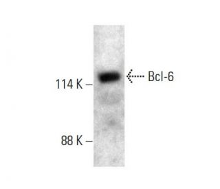 BCL ペナント 6枚 ImmunoCult-XF B Cell Base Medium | 製品情報 | ベリタス
