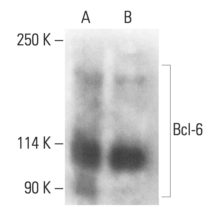 Bcl-6 Antibody (D-8) | SCBT - Santa Cruz Biotechnology