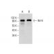 western blotting image from recommended Bcl-6 (D-8) monoclonal antibody replacement. Image 288289