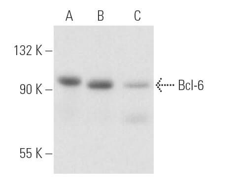 Bcl-6 Antibody (PG-B6P) | SCBT - Santa Cruz Biotechnology