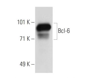Bcl-6 Antibody (PG-B6P) | SCBT - Santa Cruz Biotechnology