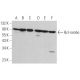 Bcl-rambo Antibody (G-9) - Western Blotting - Image 379448 
