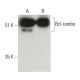 Bcl-rambo Antibody (G-9) - Western Blotting - Image 396510 