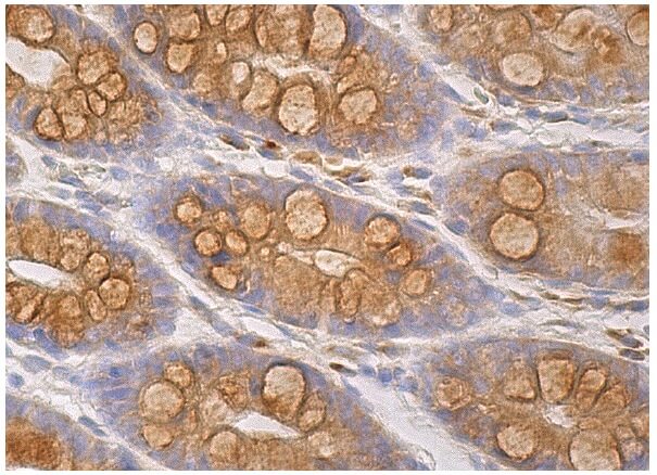 Bcl-xS/L Antibody (D-3) | SCBT - Santa Cruz Biotechnology
