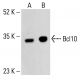 Bcl10 Antibody (151) - Western Blotting - Image 413160