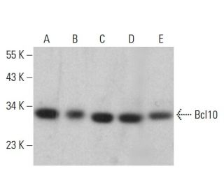 Bcl10 Antibody (4F8E8H8) - Western Blotting - Image 380426 