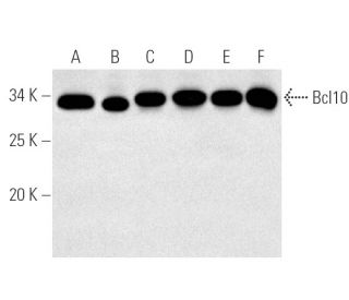 western blotting image from recommended Bcl10 (331.3) monoclonal antibody replacement. Image 174