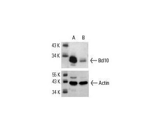 Bcl10 siRNA (h): sc-29793. Western blot analysis of Bcl10 expression in non-transfected control (A) and Bcl10 siRNA transf 