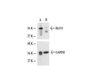 Bcl10 siRNA (m): sc-29794. Western blot analysis of Bcl10 expression in non-transfected control (A) and Bcl10 siRNA transf 