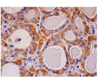 Bcr Antibody (G6) - Immunohistochemistry - Image 287242 