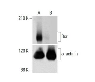 Bcr HDR Plasmid (h): sc-401514-HDR. Western blot analysis of Bcr expression in non-transfected control (A) and puromycin,