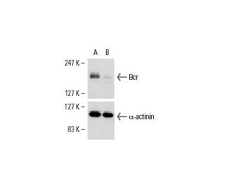 Bcr siRNA (h): sc-29795. Western blot analysis of Bcr expression in non-transfected control (A) and Bcr siRNA transfected 
