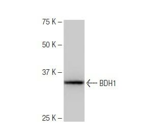 BDH1 Antibody (6-RY34) - Western Blotting - Image 64870