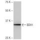 BDH1 Antibody (6-RY34) - Western Blotting - Image 64870