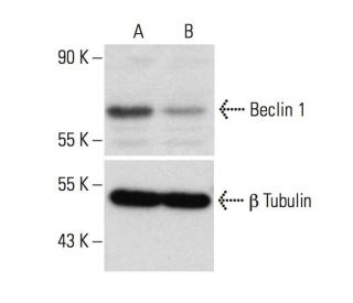 Beclin 1 siRNA (h): sc-29797. Western blot analysisof Beclin 1 expression in non-transfected control (A) and Beclin 1 siRN 
