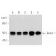 This polyclonal antibody has been discontinued. See our recommended <a href="beclin-1-antibody-e-8">BECN1/Beclin-1 (E-8)</a> monoclonal antibody (sample data shown). western blotting image from recommended BECN1/Beclin-1 (E-8) monoclonal antibody replacement. Image 320897