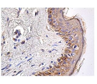immunohistochemistry image from recommended Bek/FGFR2 (C-8) monoclonal antibody replacement. Image 156633