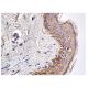 immunohistochemistry image from recommended Bek/FGFR2 (C-8) monoclonal antibody replacement. Image 156633
