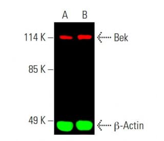 Bek/FGFR2 Antibody (C-8) - Western Blotting - Image 388236The Double Nickase Plasmid features a U6 promoter for sgRNA expression, a 20 nt targeting sequence, and a gRNA scaffold to guide Cas9n. It includes a CBh promoter for Cas9n (D10A) and puromycin resistance, GFP for transfection verification, and nuclear localization signals (NLS). The 2A peptide allows co-expression of Cas9n and Puro from a single promoter, enabling precise genome editing with reduced off-target effects.
