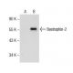 Bestrophin-2 Antibody (B-5) - Western Blotting - Image 157702