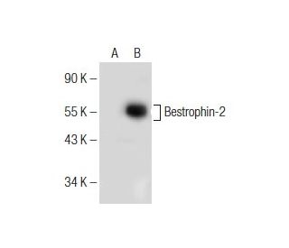 Bestrophin-2 Antibody (D-7) - Western Blotting - Image 155279