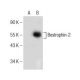 Bestrophin-2 Antibody (D-7) - Western Blotting - Image 155279