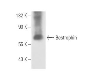 western blotting image from recommended Bestrophin (E6-6) monoclonal antibody replacement. Image 10094