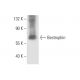 western blotting image from recommended Bestrophin (E6-6) monoclonal antibody replacement. Image 10094