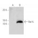 Bet1L (19): sc-135846. Western blot analysis of Bet1L expression in non-transfected: sc-117752 (A) and human Bet1L transfe