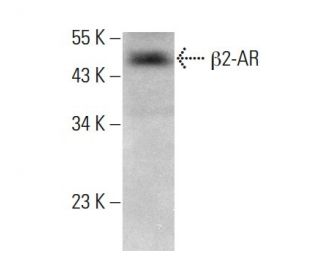 beta 2 Adrenergic Receptor/ADRB2/&beta;2-AR Antibody (E-3) - Western Blotting - Image 379893SAM Transcription Activation: SAM system utilizing dCas9-VP64, MS2-P65-HSF1, and sgRNA for precise gene transcription activation. 