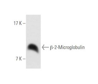 &beta;-2-Microglobulin Antibody (BBM.1) - Western Blotting - Image 61980 