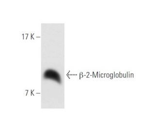 western blotting image from recommended β-2-Microglobulin (BBM.1) monoclonal antibody replacement. Image 61980