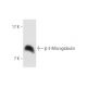 This polyclonal antibody has been discontinued. See our recommended <a href="beta-2-microglobulin-antibody-bbm-1">β-2-Microglobulin (BBM.1)</a> monoclonal antibody (sample data shown). western blotting image from recommended β-2-Microglobulin (BBM.1) monoclonal antibody replacement. Image 61980